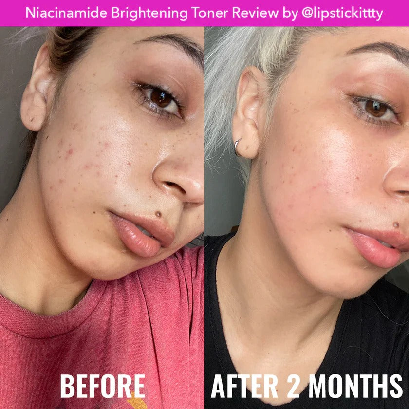 Niacinamide Brightening Toner Good Molecules
