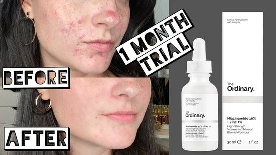 Niacinamide 10% + Zinc 1% Oil Control Serum The Ordinary